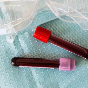 Anzyment & Blood Purifier