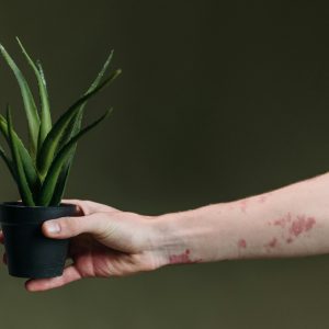 Anti Fungal & Scabies